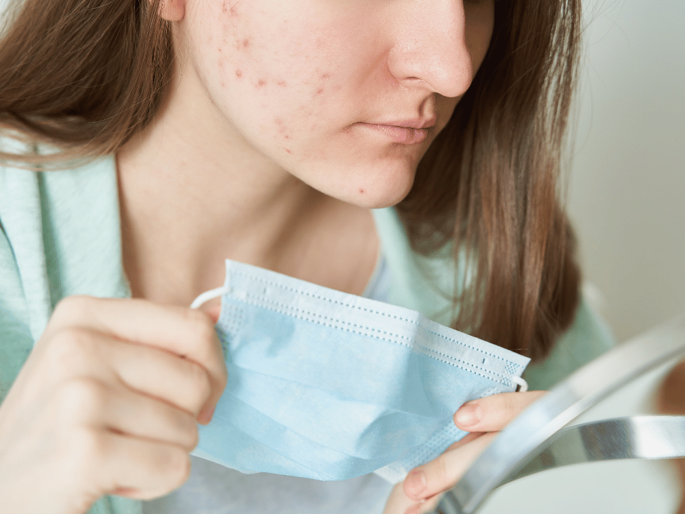 The effect of unhealthy food on the skin of the face